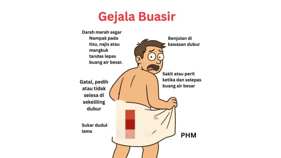 Panduan Buasir Pelajar 2026: Punca, Rawatan & Kos